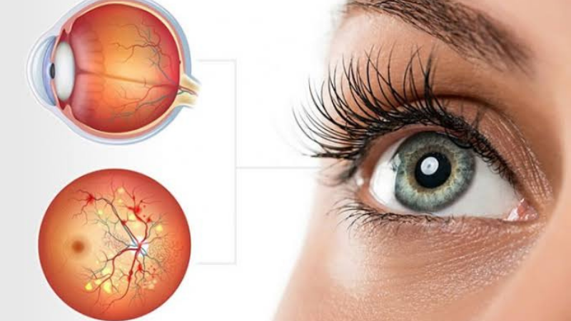 Göz Hastalıkları (Retina-Kornea)